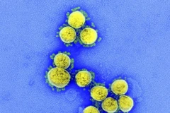 Hình ảnh từ kính hiển vi do Viện Y tế quốc gia Mỹ cung cấp cho thấy virus SARS-CoV-2 trong mẫu bệnh phẩm của bệnh nhân mắc COVID-19 ở Mỹ. (Ảnh: AFP/TTXVN) 