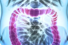 Ảnh minh họa. (Nguồn: healthgrades.com) 