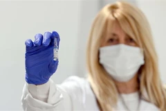 Xe của Đại sứ Nga tại Cộng hòa Séc. (Nguồn: EPA) 