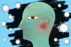 Ảnh minh họa. (Nguồn: news.mit.edu) 