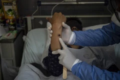 Nốt đậu mùa khỉ trên tay một bệnh nhân. (Ảnh: AFP/TTXVN) 