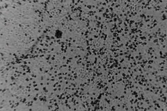 Phương pháp này có thể áp dụng, chẳng hạn như đối với virus corona mới ở Trung Quốc. (Nguồn: Keystone) 