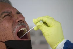 [Video] Xét nghiệm nước bọt để chẩn đoán virus SARS-CoV-2