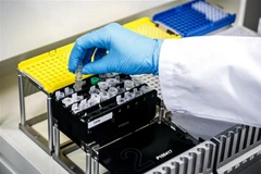 Kỹ thuật viên xét nghiệm mẫu bệnh phẩm COVID-19 trong phòng thí nghiệm tại Roosendaal, Hà Lan, ngày 4/3/2020. (Nguồn: AFP/TTXVN) 
