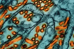 Các hạt virus cúm gia cầm H5N1 (màu cam) dưới kính hiển vi. (Nguồn: Statnews)