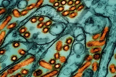 Các hạt virus cúm gia cầm H5N1 (màu cam) dưới kính hiển vi. (Nguồn: Statnews)