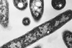 ​Vi khuẩn Legionella dưới kính hiển vi. (Nguồn: AP)