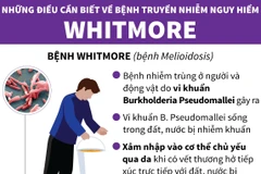 [Infographics] Những điều cần biết về căn bệnh nguy hiểm Whitmore