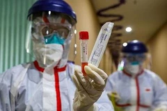 [Video] Quy trình đặc biệt lấy mẫu xét nghiệm SARS-CoV-2 ở Hàn Quốc