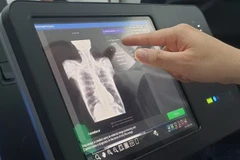 Máy chụp X-quang tích hợp trí tuệ nhân tạo được triển khai phục vụ người dân xã đảo Thạnh An, huyện Cần Giờ, Thành phố Hồ Chí Minh. (Ảnh: TTXVN phát)