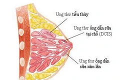 Ảnh minh họa. (Nguồn: Internet)