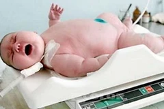 Một bé sơ sinh "khổng lồ." Ảnh minh họa. (Nguồn: RN)