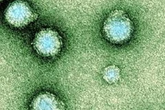 Virus chikungunya. (Nguồn: Internet) 