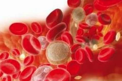 Ảnh minh họa. (Nguồn: Internet)