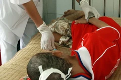 Các bệnh nhân HIV/AIDS sẽ có thêm hy vọng với loại thuốc mới Edurant. (Ảnh minh họa: Dương Ngọc/TTXVN)