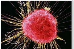 Tế bào ung thư (Ảnh: Bild)