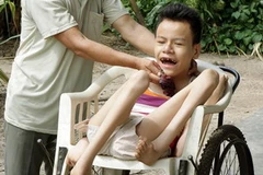 Một nạn nhân chất độc da cam/dioxin. (Ảnh: Dương Ngọc/ TTXVN)