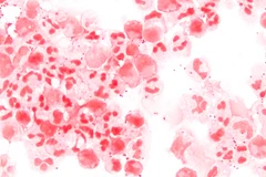 Vi khuẩn Neisseria meningitidis. (Nguồn: Wikipedia)
