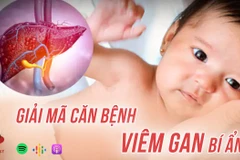 [Audio] Giải mã căn bệnh viêm gan bí ẩn khiến ba bệnh nhi tử vong