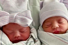 Hai bé Alfredo và Aylin ở bang California (Mỹ) là một cặp sinh đôi nhưng lại có ngày tháng năm sinh hoàn toàn khác nhau. Trường hợp hiếm gặp này xảy ra khi cặp vợ chồng Fatima Madrigal và Robert Trujillo tới sinh con tại Trung tâm y tế Natividad. Cậu con 