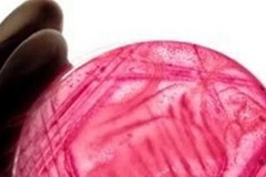 Enzym NDM-1 được phát hiện trong cả vi khuẩn E.coli. (Ảnh: BBC)
