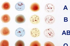 Ảnh chỉ mang tính minh họa. (Nguồn: Internet)