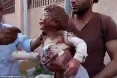 Bé gái Syria tội nghiệp. (Nguồn: Daily Mail)
