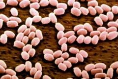 Virus gây bệnh than qua kính hiển vi. (Nguồn: BBC)