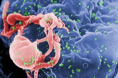 Virus HIV nhìn qua kính hiển vi. (Nguồn: ANSA)