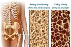 (Ảnh minh họa: Internet)