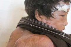 Cháu Hào Anh. (Ảnh: Internet)