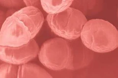 Hải Dương: Bệnh nhân đầu tiên tử vong do bệnh viêm não mô cầu