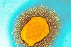 Hình ảnh virus đậu mùa khỉ dưới kính hiển vi điện tử. (Ảnh: Cơ quan an ninh y tế Anh/TTXVN)