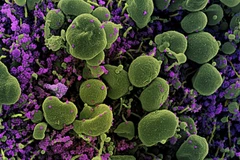 Hình ảnh quét qua kính hiển vi điện tử cho thấy tế bào (màu xanh) bị virus SARS-COV-2 (màu tím) xâm nhập. (Ảnh: AFP/TTXVN)