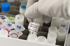 Nghiên cứu vắcxin phòng bệnh COVID-19. (Nguồn: AFP/TTXVN)