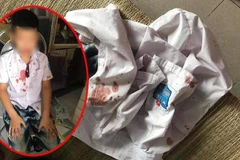 Làm rõ việc một phụ huynh bạo hành học sinh lớp 1 ở Hòa Bình