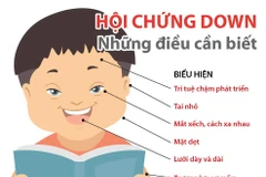 Những điều cần biết về Hội chứng Down ở trẻ