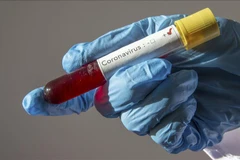 Ảnh minh họa. (Nguồn: aa.com.tr)