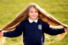 Cô bé mắc bệnh lạ khiến tóc mọc dài như Rapunzel
