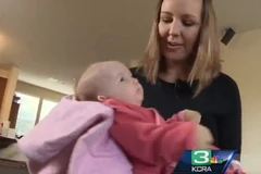 Xót xa bé gái không thể được ôm vì bị thượng bì bóng nước 