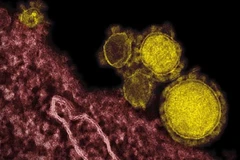 Số ca tử vong do MERS ở Saudi Arabia tăng lên 66 người