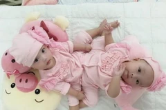 Hai bé gái Trúc Nhi và Diệu Nhi. (Ảnh: BVCC)