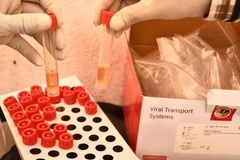 Ảnh chỉ có tính minh họa. (Nguồn: The Hindu)