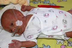 Tom Thumb được về nhà khi đạt 3,7kg. (Ảnh: Sky News)