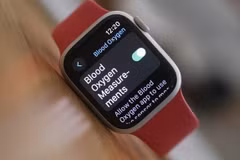 Mẫu đồng hồ thông minh Apple Watch 9 hiển thị nồng độ nồng độ oxy trong máu tại Los Angeles, Mỹ, ngày 26/12/2023. (Ảnh: AFP/TTXVN)