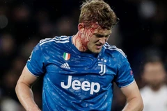 Trung vệ De Ligt gặp chấn thương vùng đầu trong trận Juventus thua 0-1 Lyon rạng sáng 27/2. (Ảnh: Getty Images)
