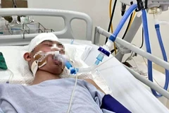 Hình ảnh nạn nhân cấp cứu tại bệnh viện. (Ảnh do gia đình em Đ. cung cấp)