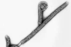 Lần đầu tiên phát hiện virus Ebola Reston ở lợn