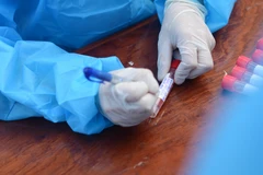 Mẫu xét nghiệm COVID-19. (Ảnh: Văn Dũng/TTXVN)