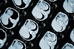 Tạo ra "dạ dày mini" đầu tiên bằng phương pháp tế bào gốc